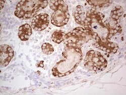 MGP Mouse anti-Human, Clone: OTI9C9, lyophilized, TrueMAB 100 &mu;g; Unconjugated:Antibodies,