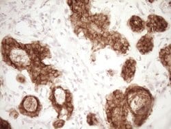 MGP Mouse anti-Human, Clone: OTI11G8, lyophilized, TrueMAB 100 &mu;g; Unconjugated:Antibodies,