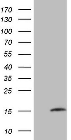MGP Mouse anti-Human, Clone: OTI11G6, lyophilized, TrueMAB 100 &mu;g; Unconjugated:Antibodies,