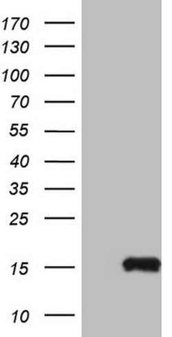 MGP Mouse anti-Human, Clone: OTI9C9, lyophilized, TrueMAB 100 &mu;g; Unconjugated:Antibodies,