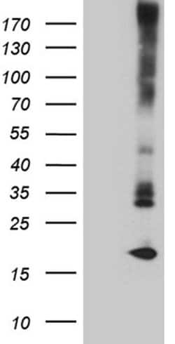 MGP Monoclonal Antibody (OTI11D9), TrueMAB , OriGene 100 &mu;L; Unconjugated:Antibodies,