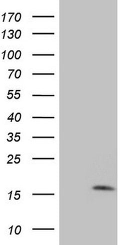 MGP Mouse anti-Human, Clone: OTI11G8, lyophilized, TrueMAB 100 &mu;g; Unconjugated:Antibodies,