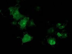 MGRN1 Monoclonal Antibody (OTI1E12), TrueMAB , OriGene 100 &mu;L; Unconjugated:Antibodies,