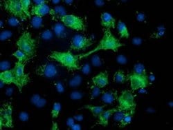 MGRN1 Monoclonal Antibody (OTI2A7), TrueMAB , OriGene:Antibodies:Primary