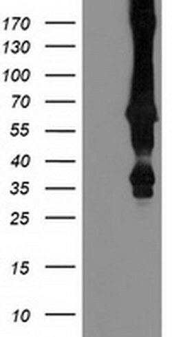 MGRN1 Monoclonal Antibody (OTI1A11), TrueMAB , OriGene 100 &mu;L; Unconjugated:Antibodies,