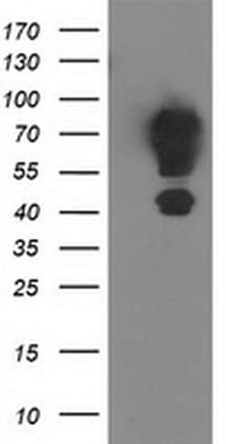 MGRN1 Monoclonal Antibody (OTI1A8), TrueMAB , OriGene 30 &mu;L; Unconjugated:Antibodies,