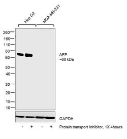 AFP Monoclonal Antibody (F1-6P2A8-P2B9A9), Invitrogen 1 mg; Unconjugated:Antibodies,