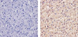 Invitrogen ApoA1 Monoclonal Antibody (513) 1 mg; Unconjugated:Antibodies,