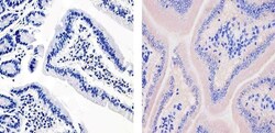 Invitrogen ApoA1 Monoclonal Antibody (513) 1 mg; Unconjugated:Antibodies,