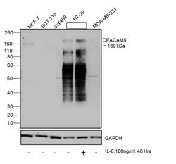 Invitrogen CEA Monoclonal Antibody (1106) 1 mg; Unconjugated:Antibodies,