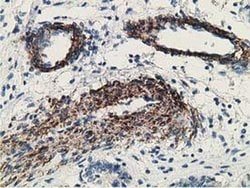 MICAL1 Monoclonal Antibody (OTI1C2), TrueMAB , OriGene 100 &mu;L; Unconjugated:Antibodies,