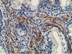 MICAL1 Monoclonal Antibody (OTI1C2), TrueMAB , OriGene 100 &mu;L; Unconjugated:Antibodies,