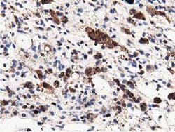 MICAL1 Monoclonal Antibody (OTI4B1), TrueMAB , OriGene:Antibodies:Primary