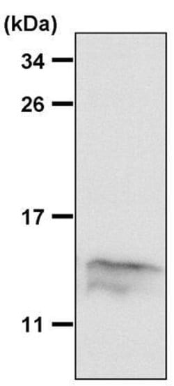 Invitrogen MIF Polyclonal Antibody 100 &mu;L | Buy Online | Invitrogen&trade; | Fisher Scientific