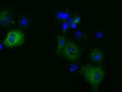MIOX Monoclonal Antibody (OTI3F11), TrueMAB , OriGene:Antibodies:Primary