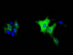 MIOX Mouse anti-Human, Clone: OTI5F8, lyophilized, TrueMAB 100 &mu;g; Unconjugated:Antibodies,