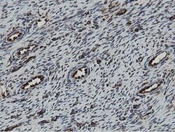 MIPEP Monoclonal Antibody (OTI5E7), TrueMAB , OriGene 100 &mu;L; Unconjugated:Antibodies,