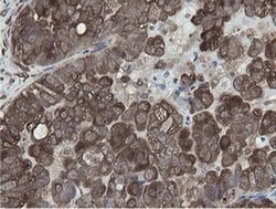 MIPEP Monoclonal Antibody (OTI5E7), TrueMAB , OriGene 100 &mu;L; Unconjugated:Antibodies,