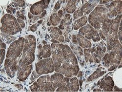 MIPEP Monoclonal Antibody (OTI5E7), TrueMAB , OriGene 100 &mu;L; Unconjugated:Antibodies,