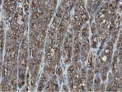 MIPEP Monoclonal Antibody (OTI5E7), TrueMAB , OriGene 100 &mu;L; Unconjugated:Antibodies,