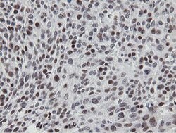 MIPEP Mouse anti-Human, Clone: OTI3F8, lyophilized, TrueMAB 100 &mu;g;