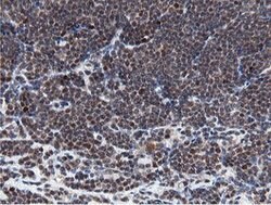 MIPEP Mouse anti-Human, Clone: OTI3F8, lyophilized, TrueMAB 100 &mu;g;