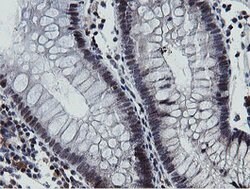 MIPEP Mouse anti-Human, Clone: OTI3F8, lyophilized, TrueMAB 100 &mu;g;
