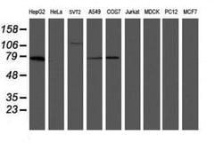 MIPEP Monoclonal Antibody (OTI4F12), TrueMAB , OriGene 100 &mu;L; Unconjugated:Antibodies,