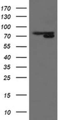 MIPEP Monoclonal Antibody (OTI5E7), TrueMAB , OriGene 100 &mu;L; Unconjugated:Antibodies,