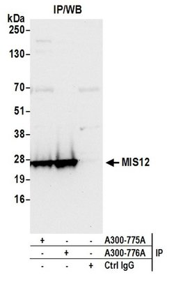MIS12 Rabbit anti-Human, Polyclonal, Bethyl Laboratories 100 &mu;L; Unconjugated:Antibodies,