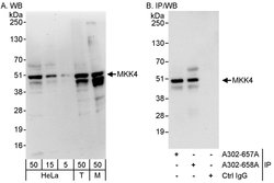 MKK4 Rabbit anti-Human, Mouse, Polyclonal, Bethyl Laboratories 100 &mu;L;