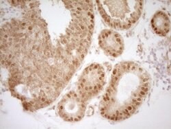 MKL1 Mouse anti-Human, Clone: OTI3G7, lyophilized, TrueMAB 100 &mu;g; Unconjugated:Antibodies,