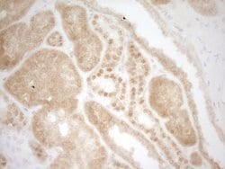 MKL1 Mouse anti-Human, Clone: OTI3G7, lyophilized, TrueMAB 100 &mu;g; Unconjugated:Antibodies,