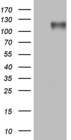 MKL1 Monoclonal Antibody (OTI2B9), TrueMAB , OriGene:Antibodies:Primary