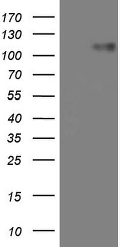 MKL1 Monoclonal Antibody (OTI3C8), TrueMAB , OriGene 100 &mu;L; Unconjugated:Antibodies,