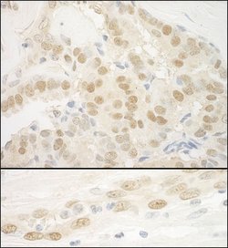 MKL2 Rabbit anti-Human, Mouse, Polyclonal, Bethyl Laboratories 100 &mu;l;