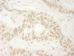 MKRN1 Polyclonal Antibody, Bethyl Laboratories:Antibodies:Primary Antibodies