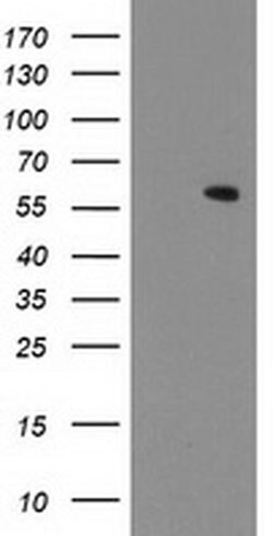 MKRN1 Monoclonal Antibody (OTI3F9), TrueMAB , OriGene 100 &mu;L; Unconjugated:Antibodies,