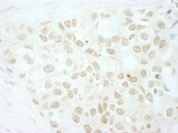 MKRN2 Rabbit anti-Human, Mouse, Polyclonal, Bethyl Laboratories 100 &mu;L;