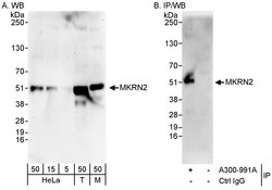 MKRN2 Rabbit anti-Human, Mouse, Polyclonal, Bethyl Laboratories 100 &mu;L;