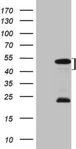 MKX Monoclonal Antibody (OTI4H10), TrueMAB , OriGene:Antibodies:Primary