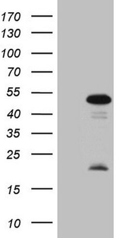 MKX Mouse anti-Human, Clone: OTI6B9, lyophilized, TrueMAB 100 &mu;g; Unconjugated:Antibodies,
