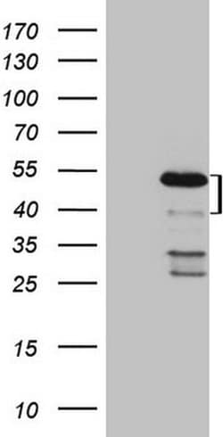 MKX Monoclonal Antibody (OTI6A12), TrueMAB , OriGene 100 &mu;L; Unconjugated:Antibodies,