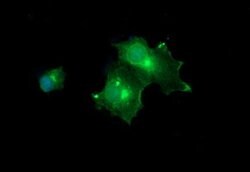MLANA Mouse anti-Human, Clone: OTI3E2, lyophilized, TrueMAB 100 &mu;g;