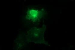 MLANA Monoclonal Antibody (OTI2G2), TrueMAB , OriGene:Antibodies:Primary