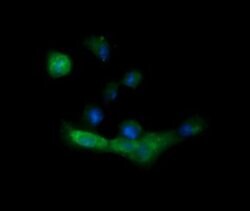 MLANA Mouse anti-Human, Clone: OTI3A2, lyophilized, TrueMAB 100 &mu;g;