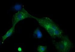 MLANA Monoclonal Antibody (OTI1F12), TrueMAB , OriGene:Antibodies:Primary