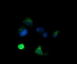 MLANA Monoclonal Antibody (OTI5E6), TrueMAB , OriGene:Antibodies:Primary