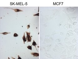 MLANA Mouse anti-Human, Clone: OTI16D9, lyophilized, TrueMAB 100 &mu;g;