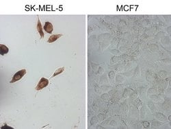MLANA Monoclonal Antibody (OTI3G1), TrueMAB , OriGene 100 &mu;L; Unconjugated:Antibodies,